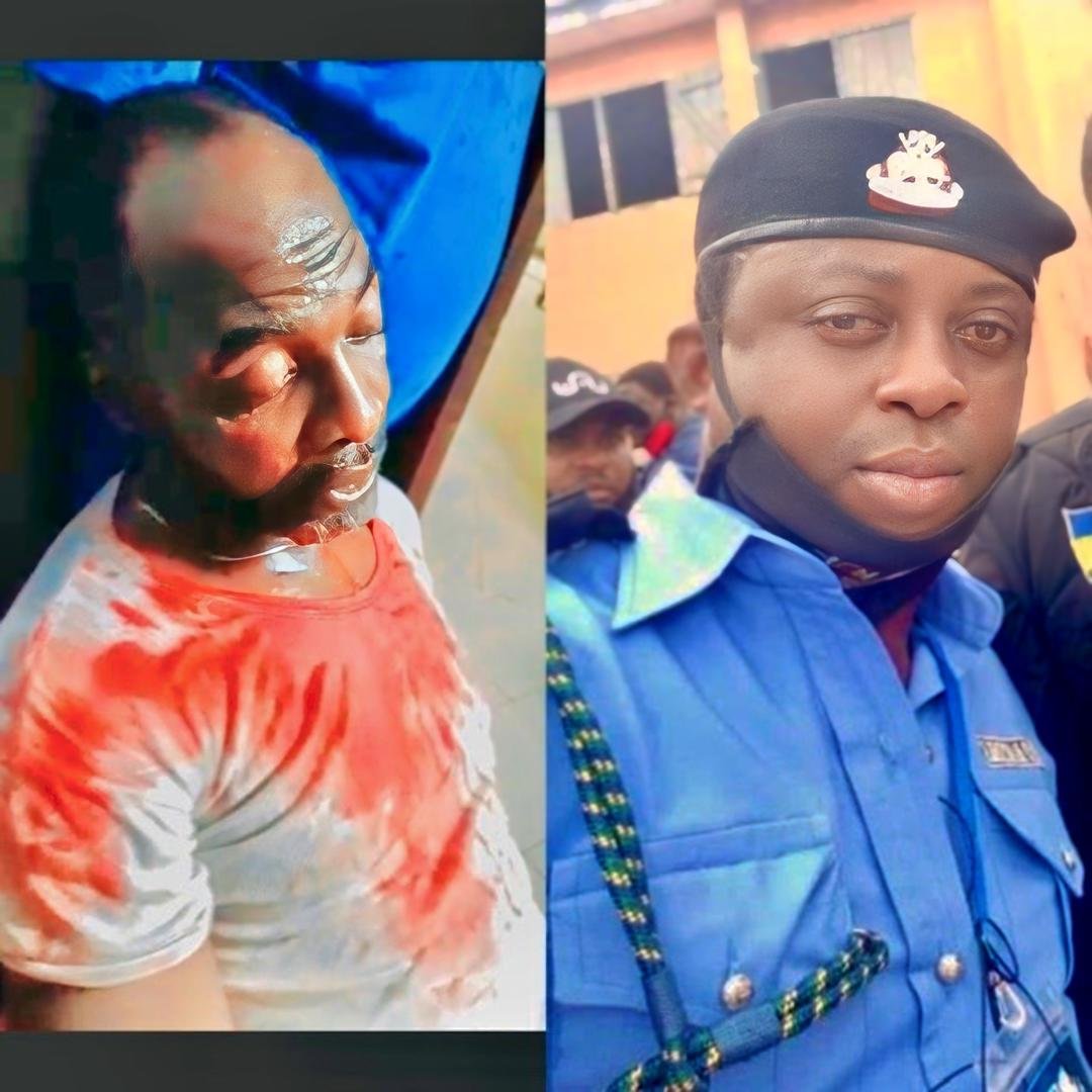 Police Brutality Sparks Outcry After Lagos Officer Allegedly Stabs Man With Broken Bottle